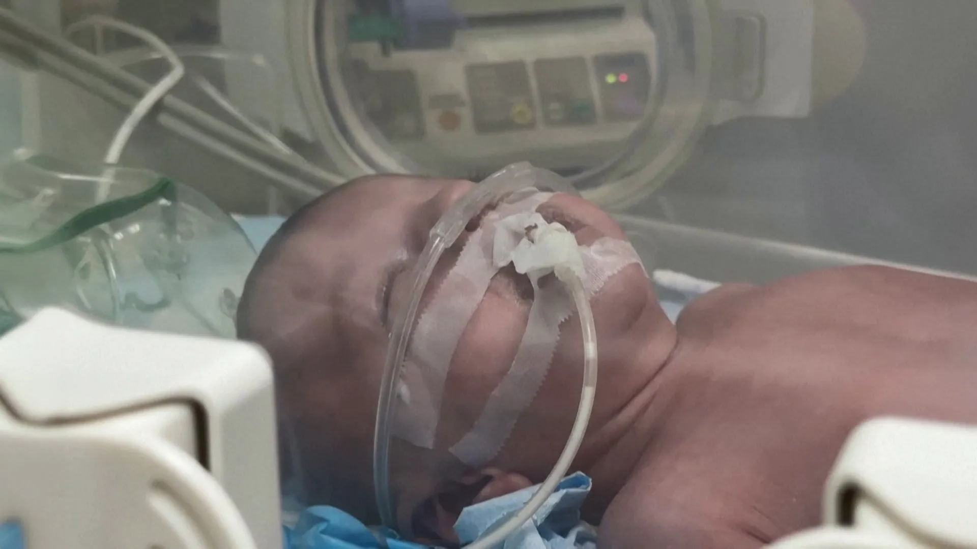 Gaza’s hospitals are running out of oxygen as healthcare nears collapse | Gaza